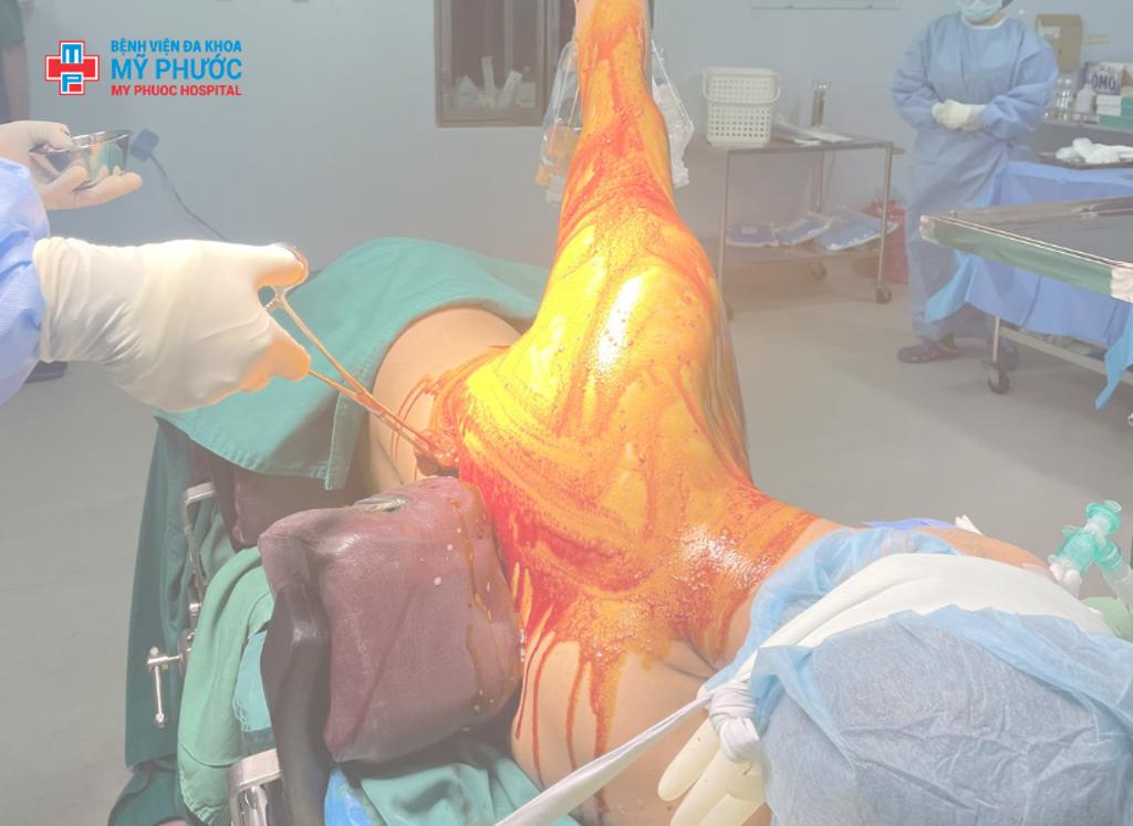 Khoa Chấn Thương Chỉnh Hình