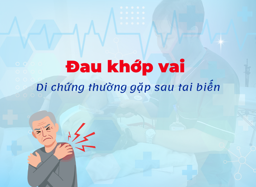 Đau khớp vai – di chứng thường gặp sau tai biến